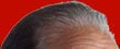 Rons Hair