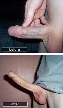 Penis Growth One